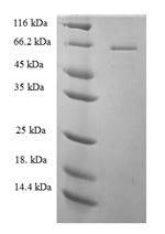 Recombinant Human 1-phosphatidylinositol 4,5-bisphosphate phosphodiesterase zeta-1 (PLCZ1) – Figure 1 of 1