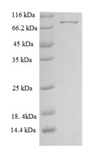 Recombinant Human Neuroepithelial cell-transforming gene 1 protein (NET1) – Figure 1 of 1
