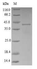 (Tris-Glycine gel) Discontinuous SDS-PAGE (reduced) with 5% enrichment gel and 15% separation gel.