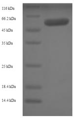 Recombinant Human Src kinase-associated phosphoprotein 1 (SKAP1) – Figure 1 of 1
