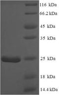 Recombinant Mouse Normal mucosa of esophagus-specific gene 1 protein (Nmes1) – Figure 1 of 1