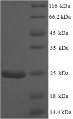 Recombinant Mouse Normal mucosa of esophagus-specific gene 1 protein (Nmes1) – Figure 1 of 1