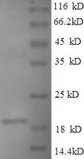 Recombinant Bacillus anthracis Single-stranded DNA-binding protein (ssb) – Figure 1 of 1