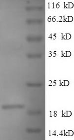 Recombinant Bacillus anthracis Single-stranded DNA-binding protein (ssb) – Figure 1 of 1