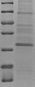 Recombinant Human Protein S100-A7A (S100A7A), partial – Figure 1 of 1