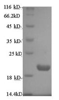 Recombinant Human Protein prune homolog (PRUNE) – Figure 1 of 1