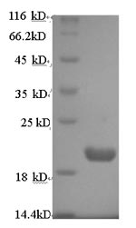 Recombinant Human Protein prune homolog (PRUNE) – Figure 1 of 1