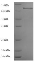 Recombinant Human Prolyl 4-hydroxylase subunit alpha-3 (P4HA3) – Figure 1 of 1