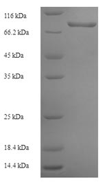 Recombinant Human Prolyl 4-hydroxylase subunit alpha-3 (P4HA3) – Figure 1 of 1