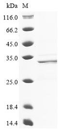 (Tris-Glycine gel) Discontinuous SDS-PAGE (reduced) with 5% enrichment gel and 15% separation gel.
