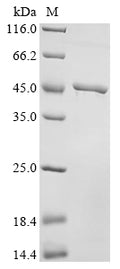 (Tris-Glycine gel) Discontinuous SDS-PAGE (reduced) with 5% enrichment gel and 15% separation gel.