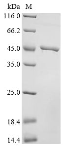 (Tris-Glycine gel) Discontinuous SDS-PAGE (reduced) with 5% enrichment gel and 15% separation gel.