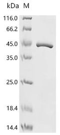 (Tris-Glycine gel) Discontinuous SDS-PAGE (reduced) with 5% enrichment gel and 15% separation gel.