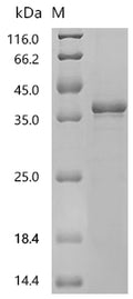 (Tris-Glycine gel) Discontinuous SDS-PAGE (reduced) with 5% enrichment gel and 15% separation gel.