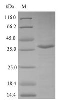 (Tris-Glycine gel) Discontinuous SDS-PAGE (reduced) with 5% enrichment gel and 15% separation gel.