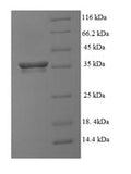 Recombinant Human Vasculin (GPBP1), partial – Figure 1 of 1