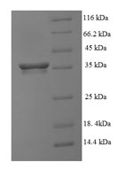 Recombinant Human Vasculin (GPBP1), partial – Figure 1 of 1