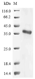 (Tris-Glycine gel) Discontinuous SDS-PAGE (reduced) with 5% enrichment gel and 15% separation gel.