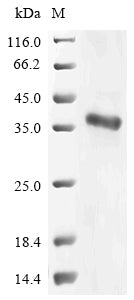 (Tris-Glycine gel) Discontinuous SDS-PAGE (reduced) with 5% enrichment gel and 15% separation gel.