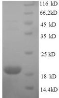 Recombinant Mouse Interferon epsilon (Ifne) – Figure 1 of 1