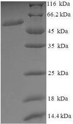 Recombinant Human Vacuolar fusion protein MON1 homolog A (MON1A), partial – Figure 1 of 1