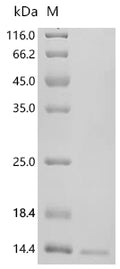 (Tris-Glycine gel) Discontinuous SDS-PAGE (reduced) with 5% enrichment gel and 15% separation gel.