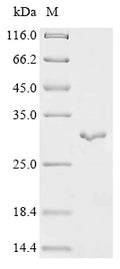 (Tris-Glycine gel) Discontinuous SDS-PAGE (reduced) with 5% enrichment gel and 15% separation gel.