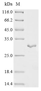 (Tris-Glycine gel) Discontinuous SDS-PAGE (reduced) with 5% enrichment gel and 15% separation gel.