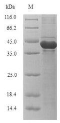 Recombinant Klebsiella oxytoca Carbapenem-hydrolyzing beta-lactamase KPC (bla) – Figure 1 of 1