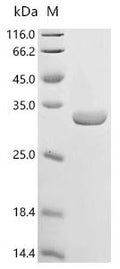 (Tris-Glycine gel) Discontinuous SDS-PAGE (reduced) with 5% enrichment gel and 15% separation gel.