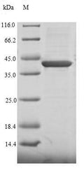(Tris-Glycine gel) Discontinuous SDS-PAGE (reduced) with 5% enrichment gel and 15% separation gel.