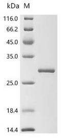 (Tris-Glycine gel) Discontinuous SDS-PAGE (reduced) with 5% enrichment gel and 15% separation gel.