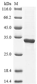 (Tris-Glycine gel) Discontinuous SDS-PAGE (reduced) with 5% enrichment gel and 15% separation gel.