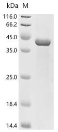 (Tris-Glycine gel) Discontinuous SDS-PAGE (reduced) with 5% enrichment gel and 15% separation gel.