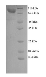 Recombinant Mouse WD repeat-containing and planar cell polarity effector protein fritz homolog (Wdpcp) – Figure 1 of 1