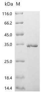 (Tris-Glycine gel) Discontinuous SDS-PAGE (reduced) with 5% enrichment gel and 15% separation gel.