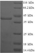Recombinant Human Homeobox protein TGIF2LX (TGIF2LX) – Figure 1 of 1