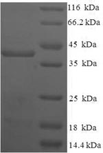 Recombinant Human Homeobox protein TGIF2LX (TGIF2LX) – Figure 1 of 1