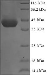 Recombinant Human Orofacial cleft 1 candidate gene 1 protein (OFCC1), partial – Figure 1 of 1