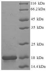 Recombinant Macaca fascicularis Frataxin, mitochondrial (FXN) – Figure 1 of 1