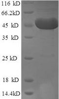 Recombinant Human m7GpppN-mRNA hydrolase (DCP2) – Figure 1 of 1