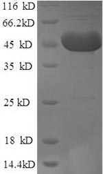 Recombinant Human m7GpppN-mRNA hydrolase (DCP2) – Figure 1 of 1