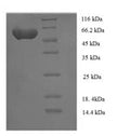 Recombinant Human Serine/threonine-protein kinase NIM1 (NIM1) – Figure 1 of 1