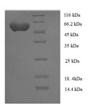 Recombinant Human Serine/threonine-protein kinase NIM1 (NIM1) – Figure 1 of 1