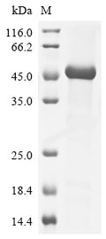 (Tris-Glycine gel) Discontinuous SDS-PAGE (reduced) with 5% enrichment gel and 15% separation gel.