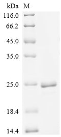 (Tris-Glycine gel) Discontinuous SDS-PAGE (reduced) with 5% enrichment gel and 15% separation gel.