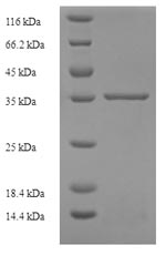 Recombinant Human Interleukin-29 (IL29), partial – Figure 1 of 1