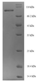 Recombinant Mouse Oxysterol-binding protein-related protein 11 (Osbpl11) – Figure 1 of 1