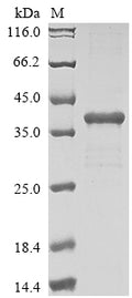 (Tris-Glycine gel) Discontinuous SDS-PAGE (reduced) with 5% enrichment gel and 15% separation gel.