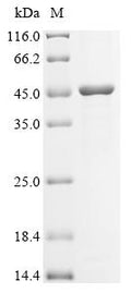 Recombinant Mouse Matrix metalloproteinase-21 (Mmp21) – Figure 1 of 1